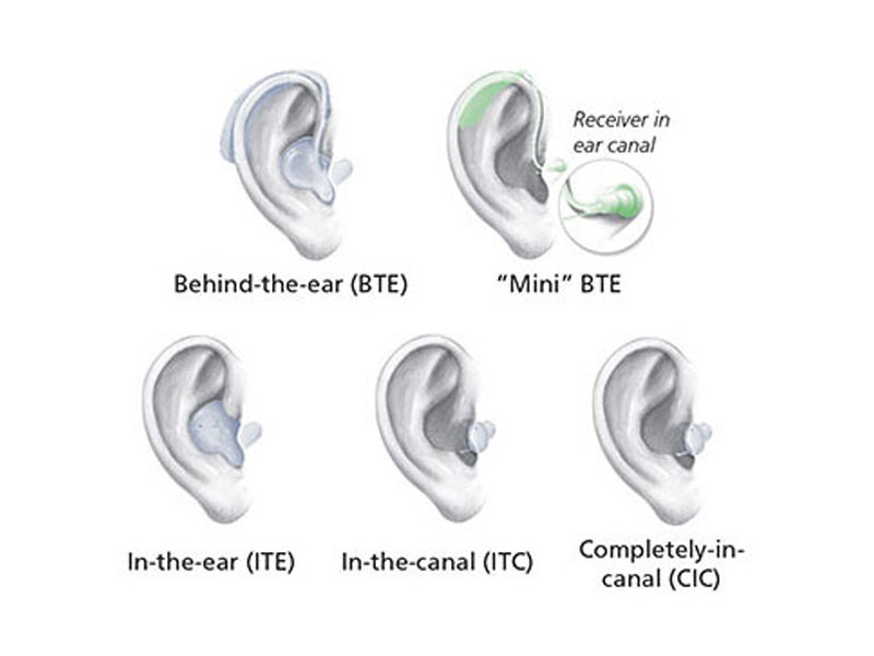 type-hear https://hnb.esimplifiedinc.com/wp-content/uploads/2023/09/type-hear.jpg